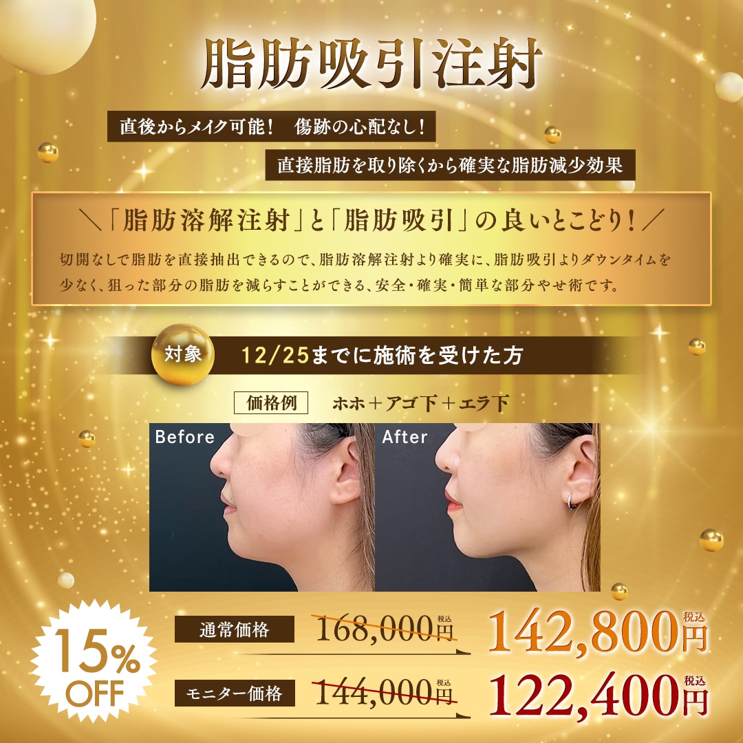 手軽でダウンタイムも短く、部分痩せに最適！