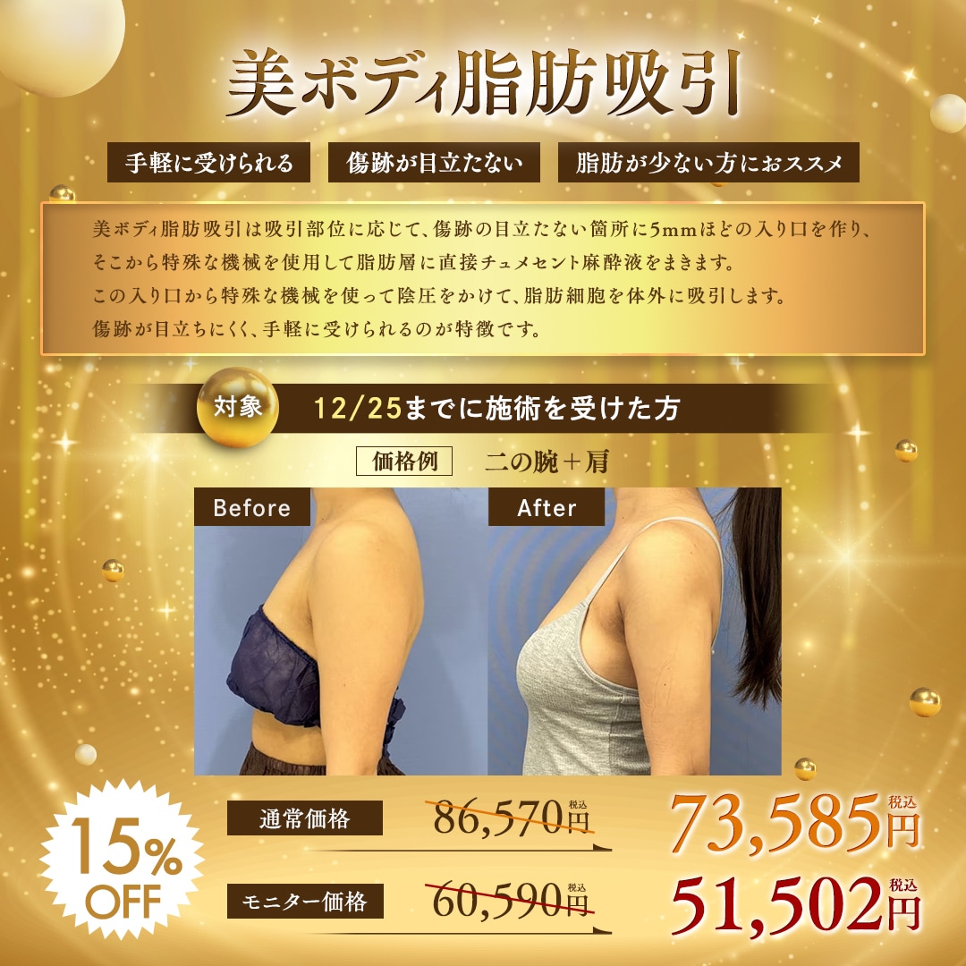 本格的な脂肪吸引で理想のラインに整える