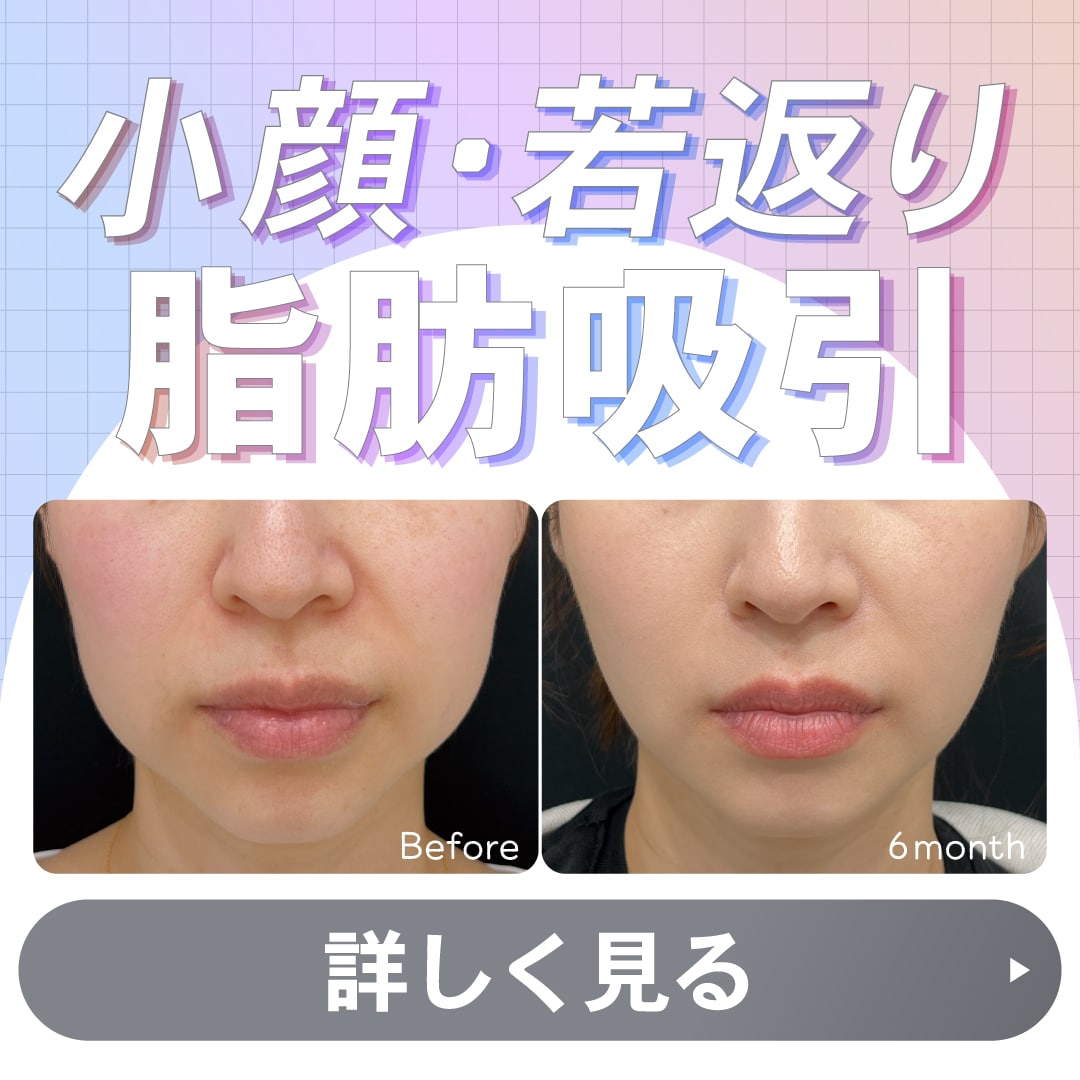 脂肪吸引・脂肪吸引注射なら湘南美容クリニック江坂院|武田院長が理想を叶える