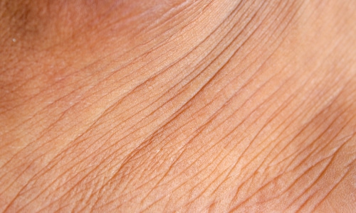 傷痕が目立ちにくい