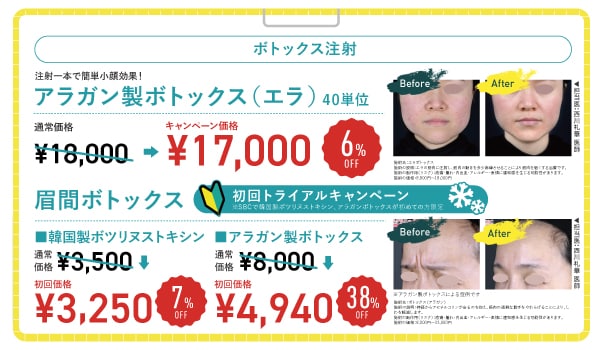 【大人気】エラボトックス