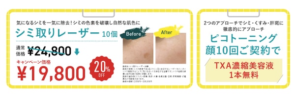 シミ取り10個・ピコトーニング10回コース