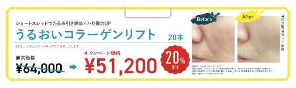 うるおいコラーゲンリフト