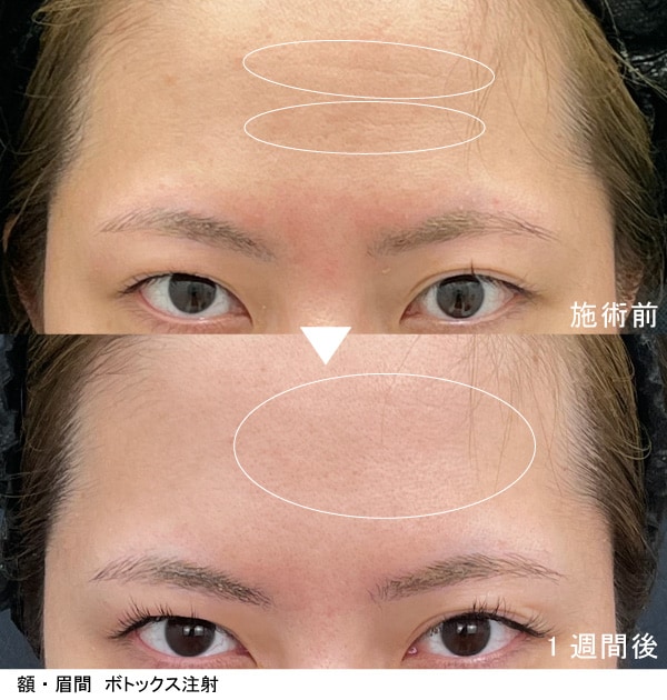 小じわ・毛穴の改善・皮脂抑制、小顔、肩こり、汗の抑制など