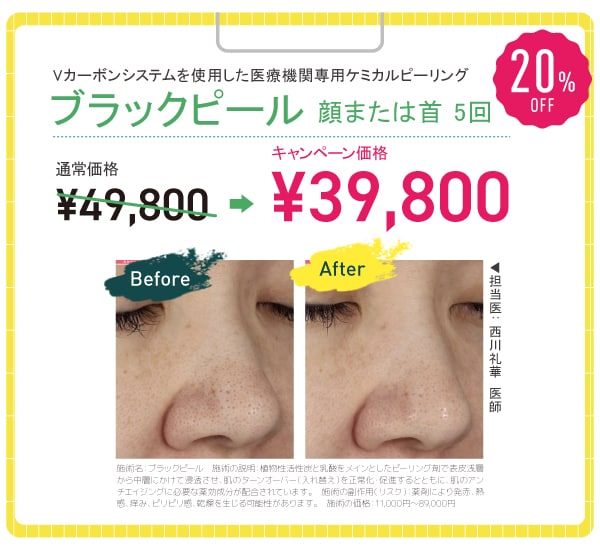 ブラックピール