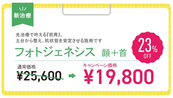 フォトジェネシス