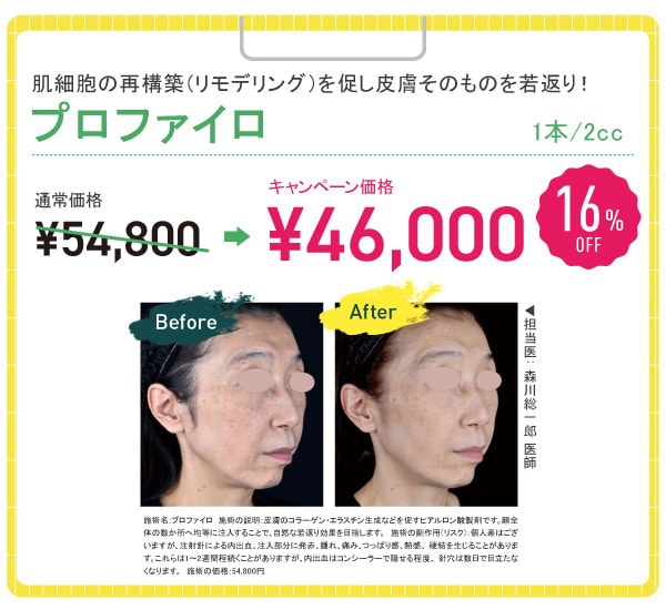 プロファイロ 16%OFF