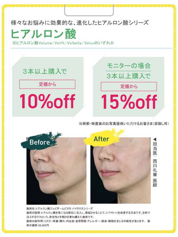 ヒアルロン酸 10%OFF
