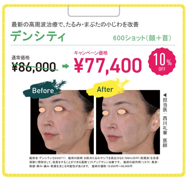 デンシティ 10%OFF