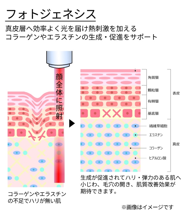 フォトジェネシス