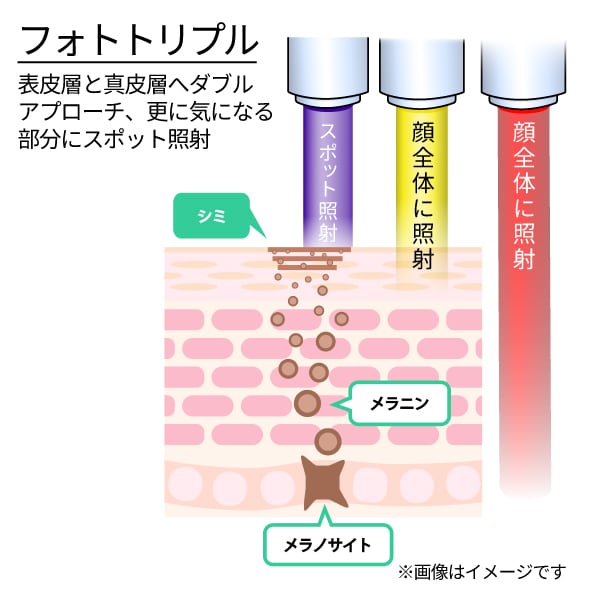 フォトトリプル