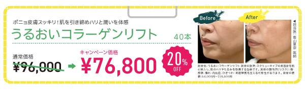 うるおいコラーゲンリフト【20% OFF】