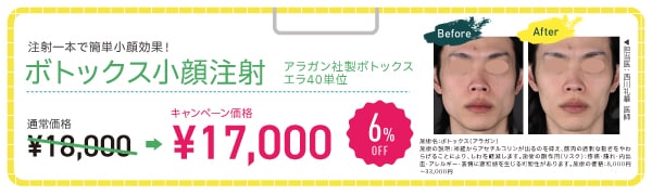 エラボトックス【6% OFF】