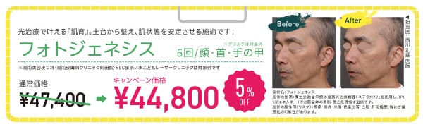 フォトジェネシス【5% OFF】