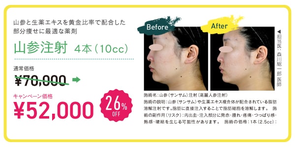 山参(サンサム)注射