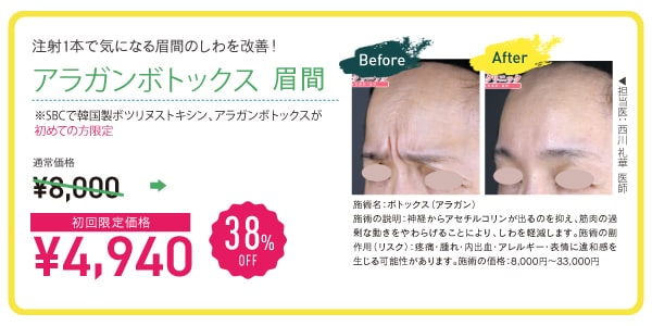 眉間ボトックス