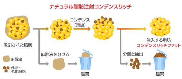 脂肪作成のイメージ
