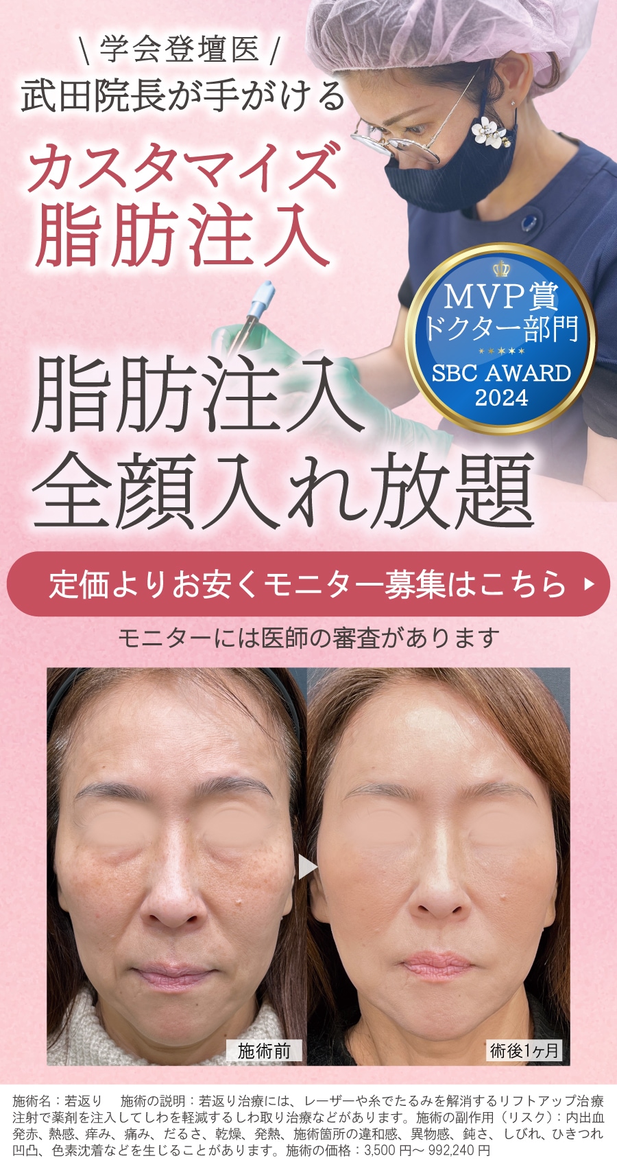 カスタマイズ脂肪注入