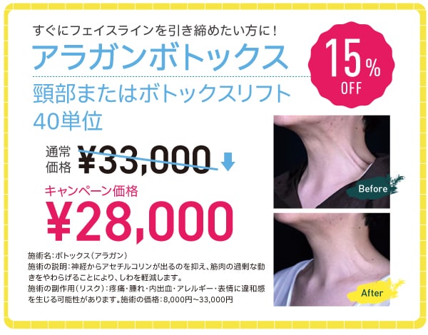 頸部ボトックス・ボトックスリフト