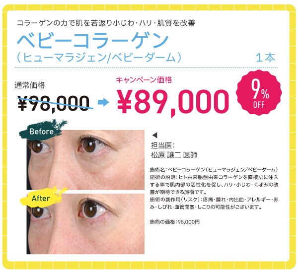 ベビーコラーゲン
