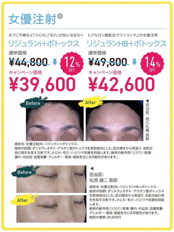 女優注射®