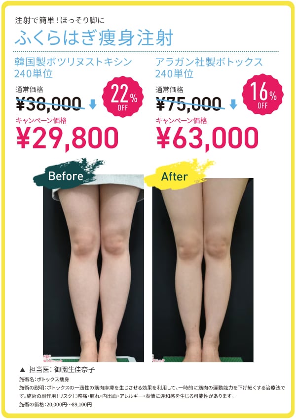 ふくらはぎボトックス MAX 22%OFF