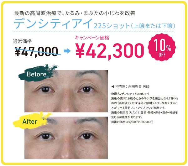 デンシティアイ 10%OFF