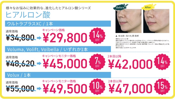 ヒアルロン酸シリーズ MAX 14%OFF