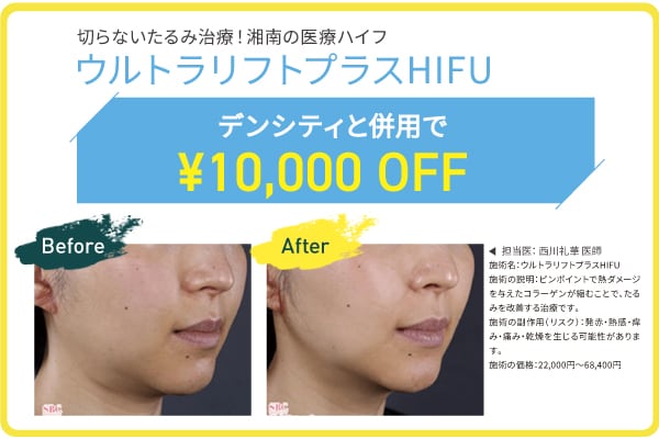HIFUとデンシティがセットでお得