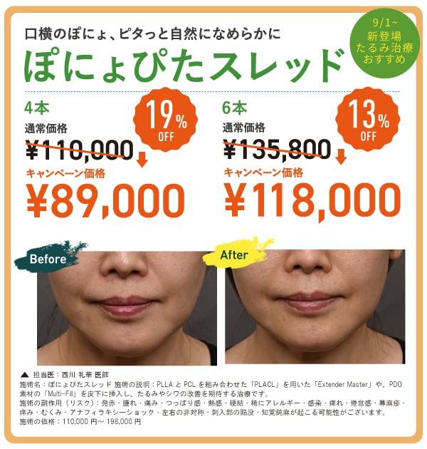 ぽにょぴたスレッド
