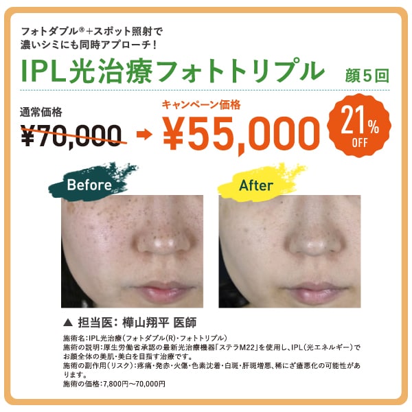 IPL光治療フォトトリプル 5回コース