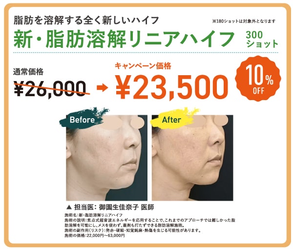 脂肪溶解リニアハイフ