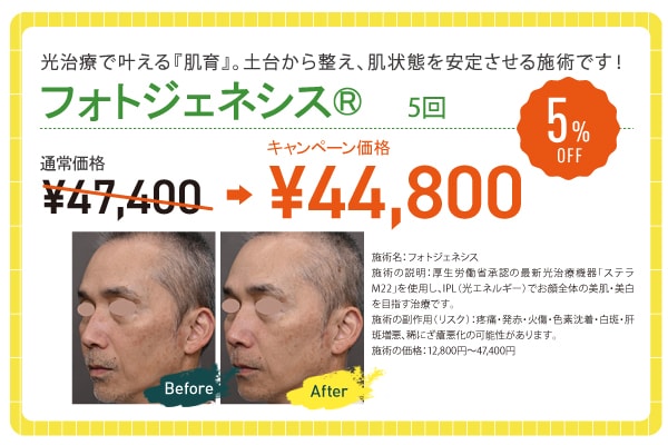 フォトジェネシス【5% OFF】