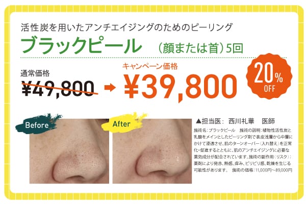 ブラックピール【20% OFF】