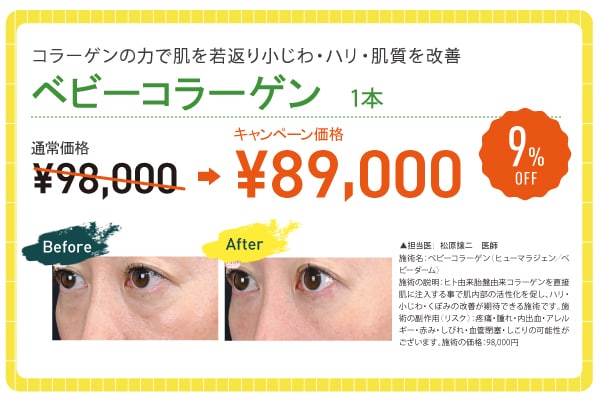 ベビーコラーゲン 【9% OFF】