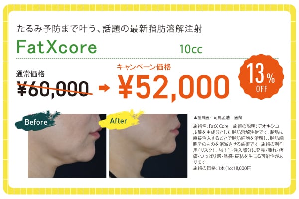 Fat X core（ファット エックス コア)【13% OFF】