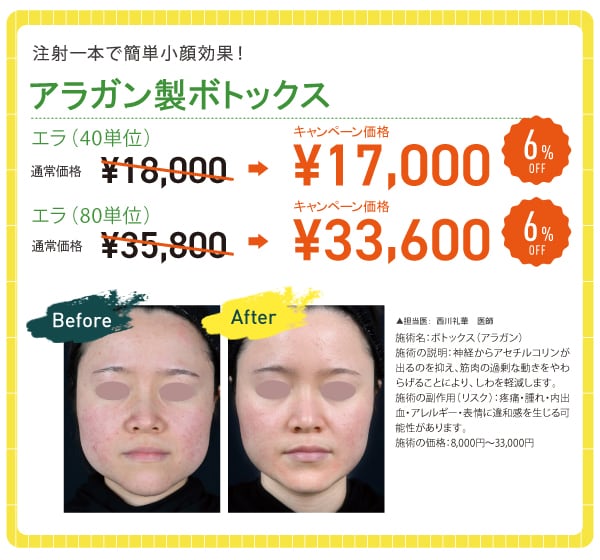 エラボトックス 【6% OFF】