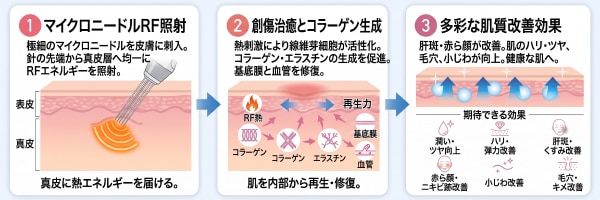 シルファームX