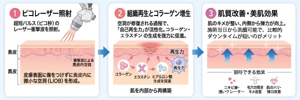 ピコレーザーフラクショナル