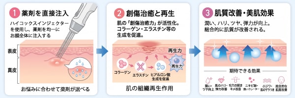 水光注射