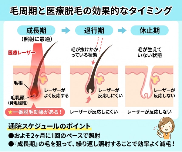 毛周期に合わせた通院スケジュール