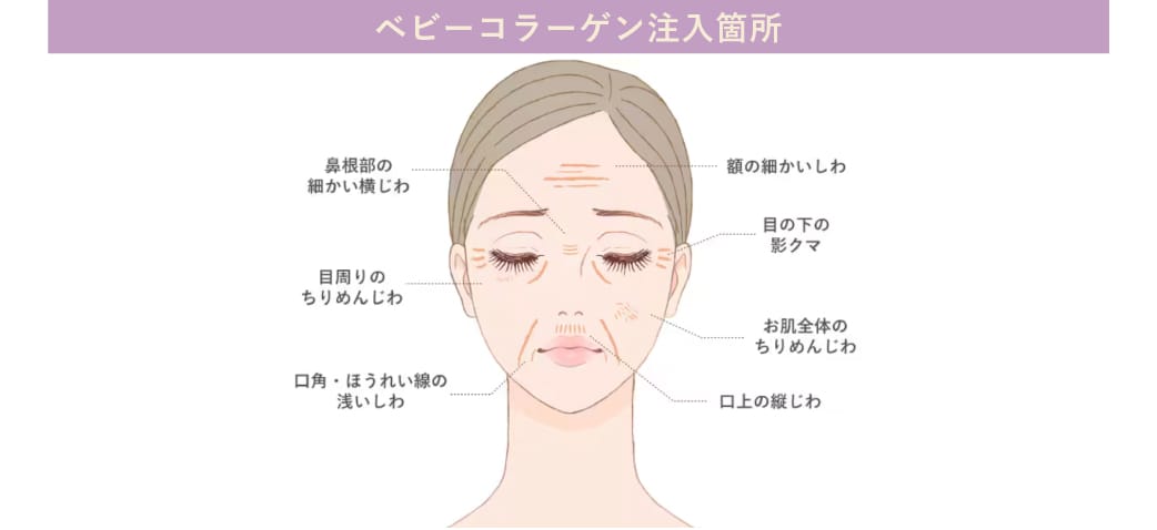 ベビーコラーゲンの特徴