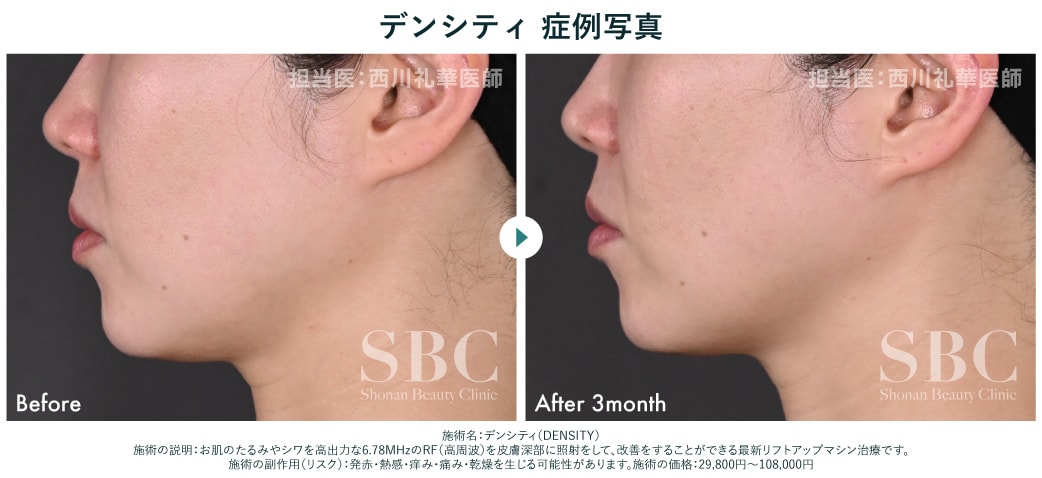 こんなお悩みの方にオススメ