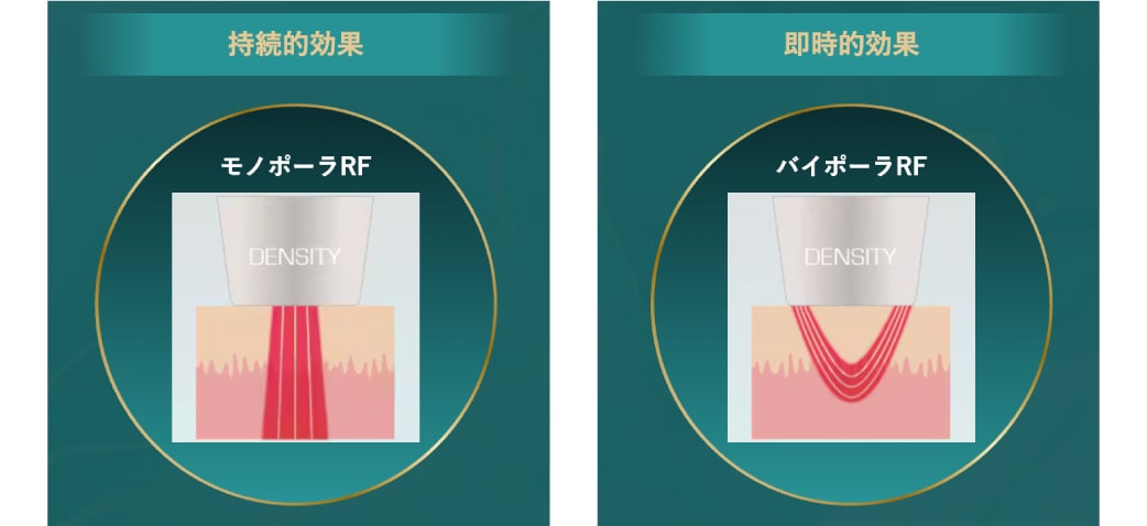デンシティの特徴