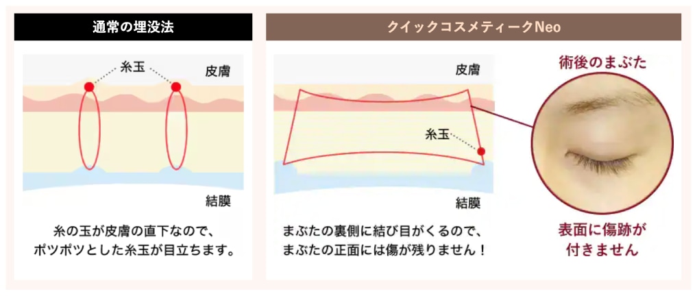 【全国の湘南美容で人気】クイックコスメティークシリーズとは？