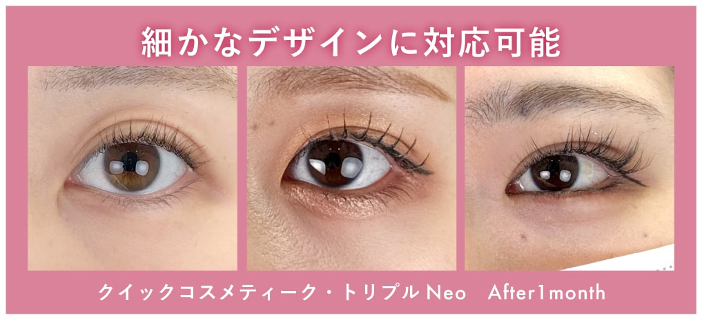 デザインの自由度が高い