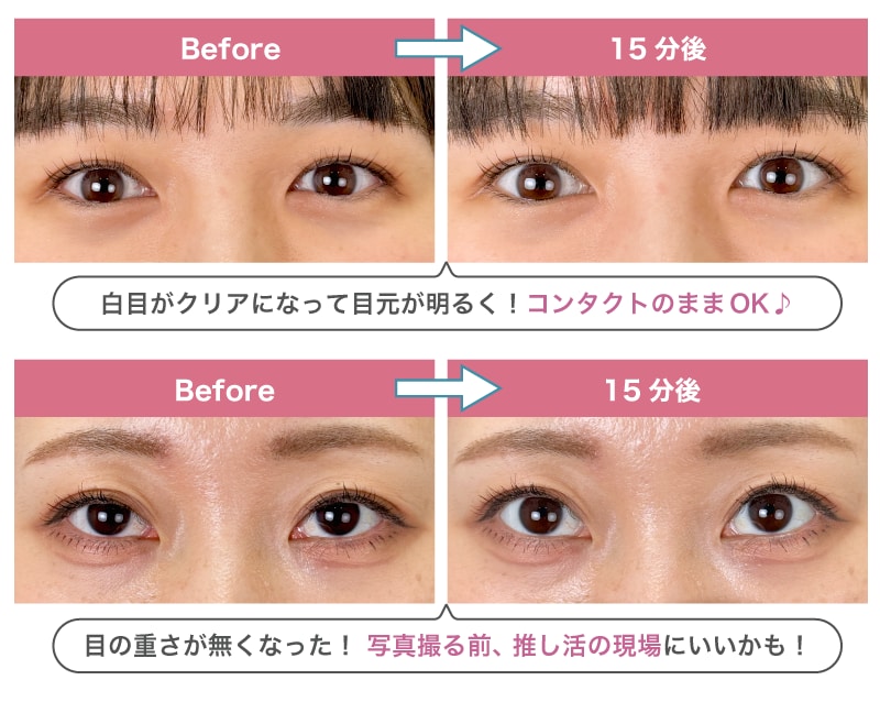 そこでおすすめなのが、“SBCアイブースター”☆彡