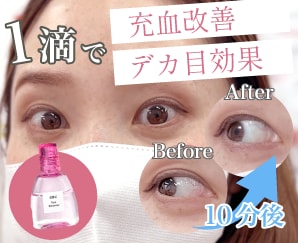 【二重整形後のダウンタイム対策】SBCアイブースターで目元の印象アップ✧˖°｜神奈川県 藤沢院