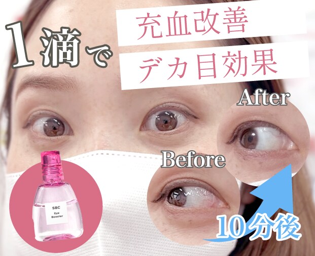 SBCアイブースター「湘南美容のデカ目薬」の通販｜楽天・湘南美容のお