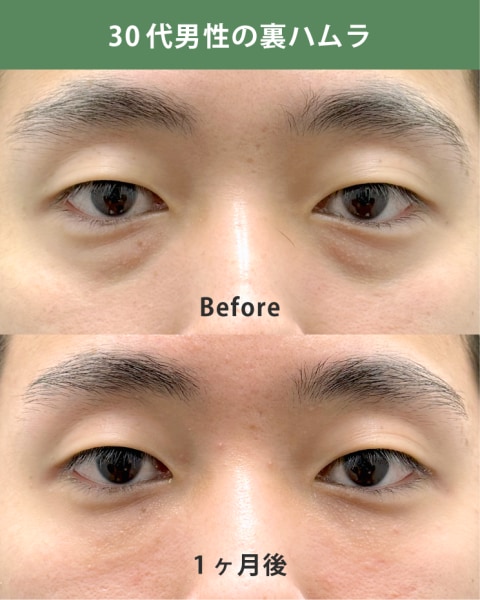 30代男性：仕事での印象を改善したい